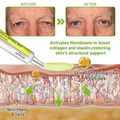 🧠👨‍⚕️Made and shipped from the USA 💫NATRAVOR® Botox & Vita-A Retinol Shot Wrinkle-Lift Tightening cream - Last Day Promotion 70% OFF